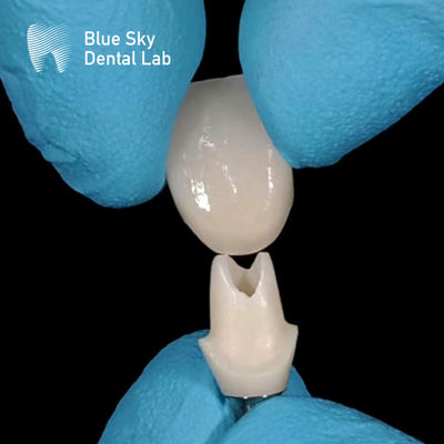Escaneamento oral Abutment de zircônio personalizado Abutments de zircônio de alta resistência