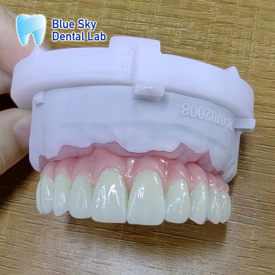 Casos de implante com superfície lisa para resultados cirúrgicos ideais
