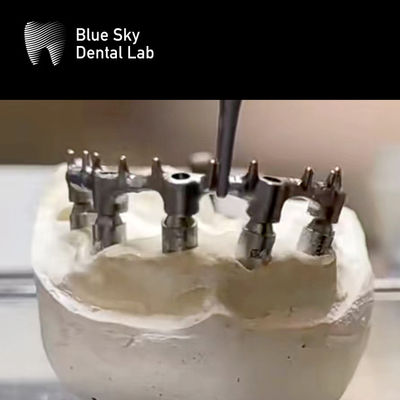 Prótese Removível Ti Bar Bar Dental Titânio Com Unhas