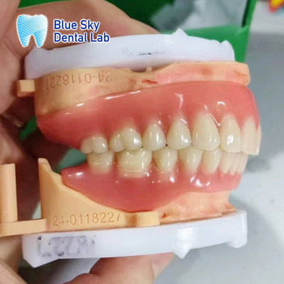 Dentadura de arco completo removível de acrílico Dentadura de aparência natural personalizável