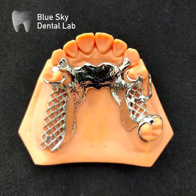 Esqueleto Cromo Dentadura Parcial de Metal Impressa Dentadura CoCr Design