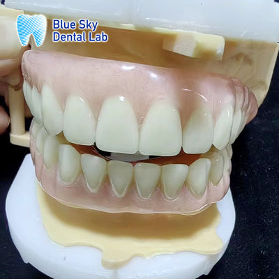 Dentadura parcial acrílica temporária azul escura Dentadura acrílica superior e inferior completa