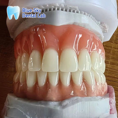 Dentadura natural completa Dentaduras removíveis acrílicas completas personalizáveis