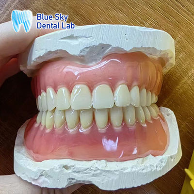Dentes ausentes Dentes de acrílico completa Restauração de Dentes de acrílico completa
