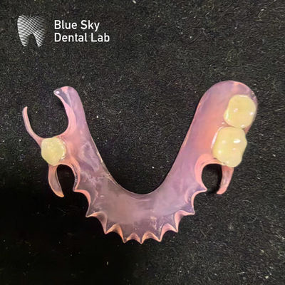Personalizar Dentes Parciais Removíveis de Acrílico