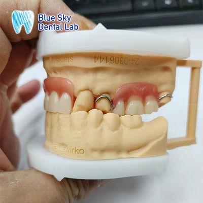 Restauração do sorriso Dentadura parcial acrílica com fechaduras