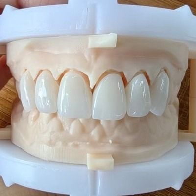 Ponte de coroa de zircônio em camadas para um sorriso bonito e boa restauração Certificação FDA e CE