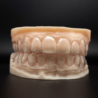 Dentes personalizáveis alinhadores invisíveis aparelhos clareadores com tempo de tratamento mais curto